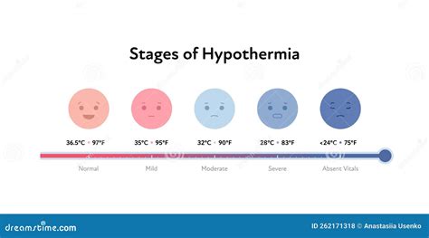 Frostbite and Hypothermia Health Care Infographic Collection. Vector Flat Healthcare ...