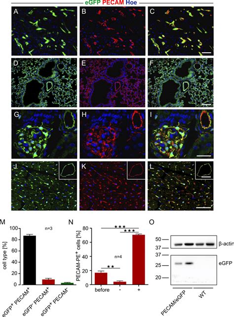 PECAM Specific EGFP Expression In Different Organs Of PECAM EGFP Adult