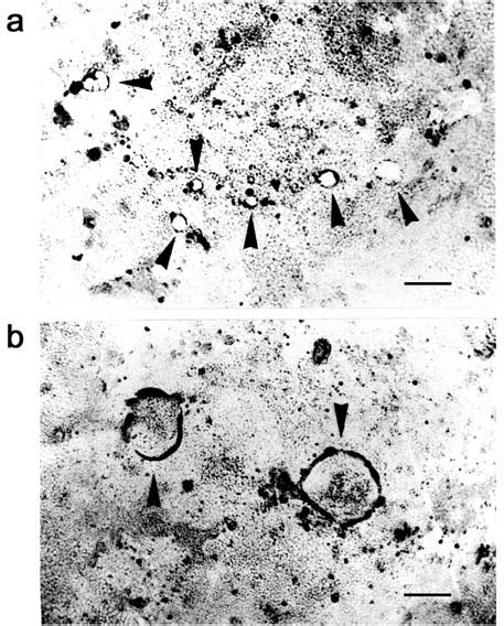 Light Micrographs Of Domes In Caco 2 Cells In The Presence Of 10Ìm Iif