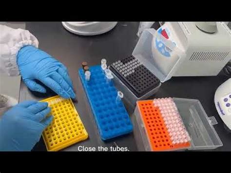 Neisseria Gonorrhoeae Chlamydia Trachomatis U Urealyticum Real Time