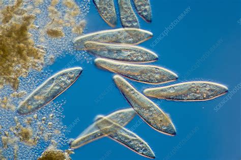 Paramecium Caudatum Stock Image C012 6275 Science Photo Library