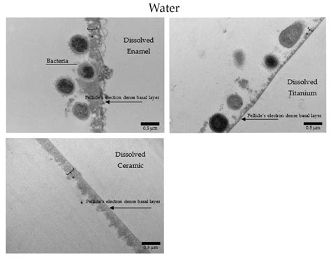 Nanomaterials | Free Full-Text | Hydroxyapatite-Based Solution as ... 