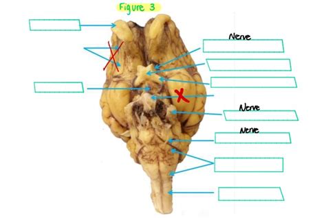 Neuro Lab Practical 1 Ventral View Figure 3 Diagram Quizlet