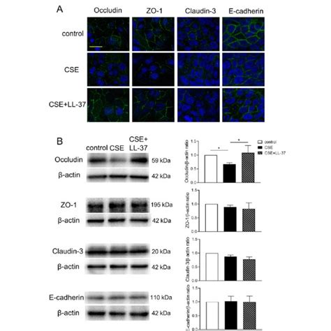 Effects Of Cse On The Gene Expression Levels Of Tj And Aj Proteins In