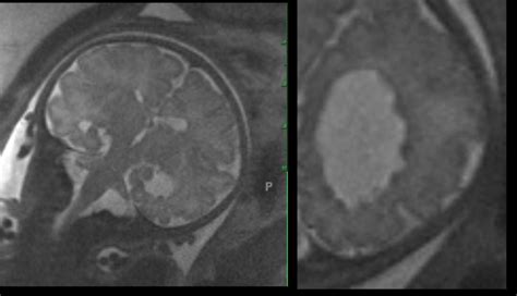 Question 83 MRI Online