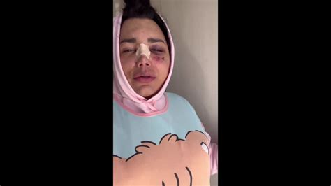 Video Paola Su Rez Reaparece Tras Ser Dada De Alta Del Hospital As