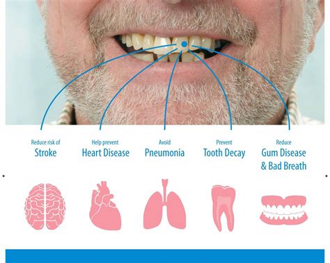 Why oral health care is important • SA Dental