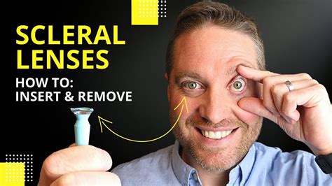 Scleral Lenses Insertion And Removal Plus Pro Tips For Beginners