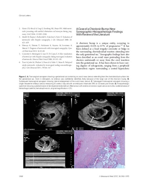 Pdf A Case Of A Chorionic Bump New Sonographic Histopathologic Findings With Review Of The