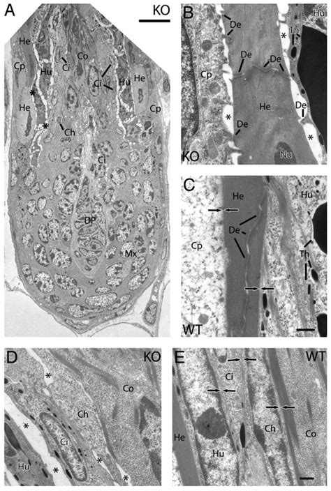 Conditional Targeting Of E Cadherin In Skin Insights Into