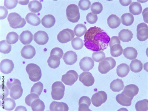 Eosinophils Microscope