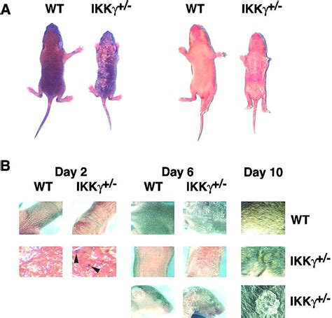 Female Mice Heterozygous For Ikkγ Nemo Deficiencies Develop A Dermatopathy Similar To The Human