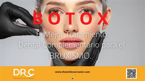 BOTOX Y BRUXISMO YouTube