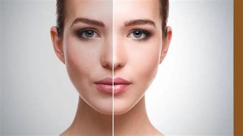 Skin Whitening Treatment, Procedures, Cost, And Side Effects - The ...