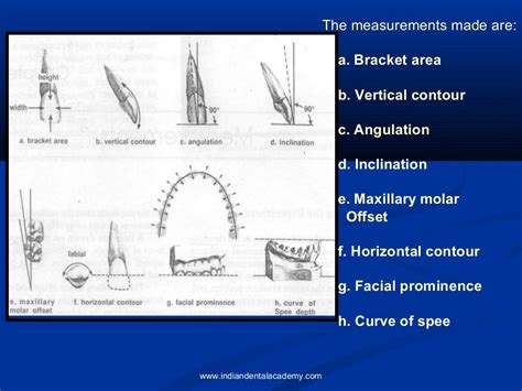 Andrews Six Keys Of Occlusion Certified Fixed Orthodontics Courses