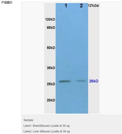 金属蛋白酶组织抑制因子 1抗体 北京拜尔迪生物技术有限公司