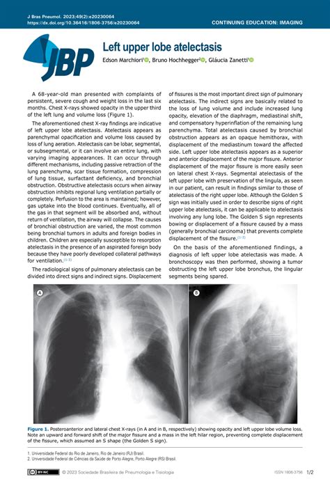 Pdf Left Upper Lobe Atelectasis