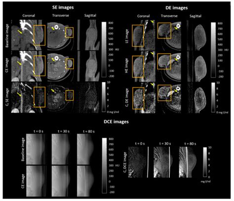 Quantitative Imaging Parameters Of Contrast Enhanced Micro Computed