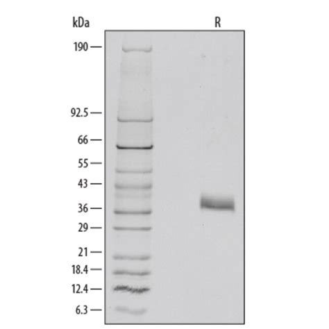 R Mouse Dkk 1 Recombinant Protein Life Sciences Protein Biology