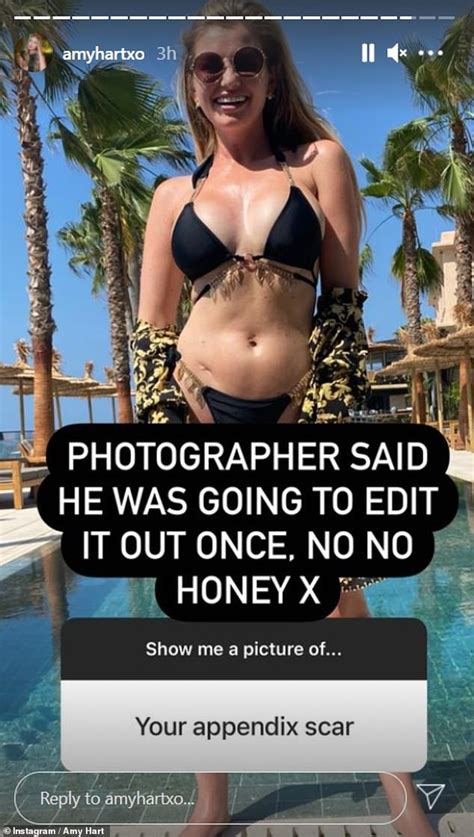 Amy Hart Displays Her Appendix Scar In A Black Bikini For Throwback Snap Daily Mail Online