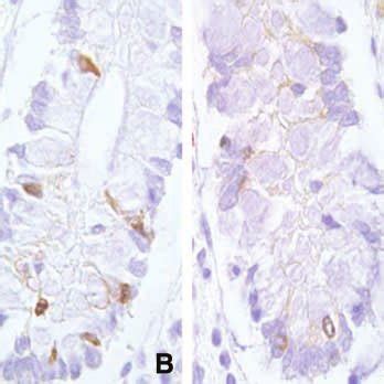 Illustrations Of Methods For Demonstrating Apoptosis In Human Colonic