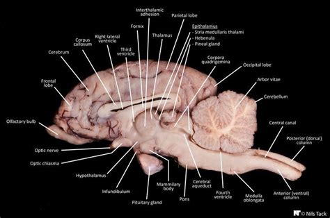 Sheep Brain Dissection Internal Anatomy Anatomy Medical Anatomy Eye Anatomy