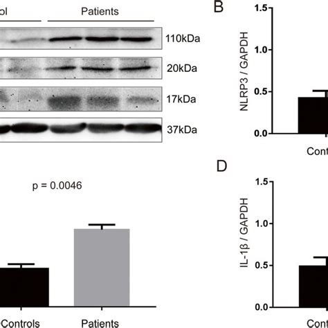 Expression Of Nlrp Inflammasome Activation Related Proteins In The