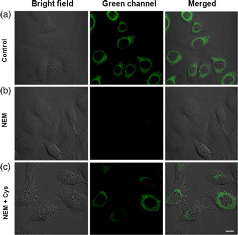 Fluorescent Images Of Hela Cells A Hela Cells Were Treated With M