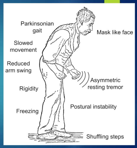 Pas Clin Med Ii Movement Disorders Neuromuscular Disorders