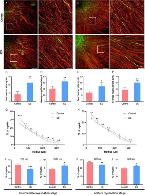 ES Enhances Myelination In The Embryo DRG Explant A Representative