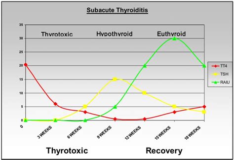 Figure Time Course Of Subacute Thyroiditis Endotext Ncbi