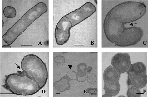 Transmission Electron Microscopy Of Mrec Depleted B Subtilis Cells