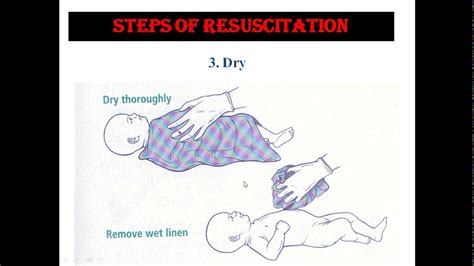 Neonatal Resuscitation Images