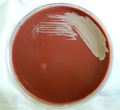 Free picture: gram, negative, francisella, tularensis, bacteria