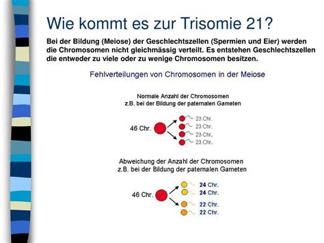 Ppt Down Syndrom Trisomie 21 Powerpoint Presentation Free Download