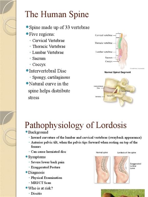 Lordosis | PDF