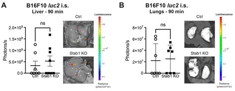 Cancers Free Full Text Deficiency Of Stabilin 1 In The Context Of