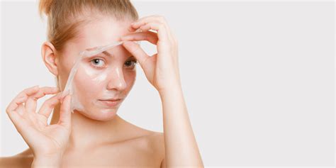 Guide To The Benefits Of Chemical Peels For Skin