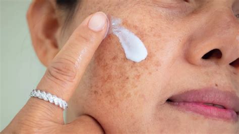 2024 Os 7 Melhores Clareadores De Melasma Hidrabene Eucerin Isdin