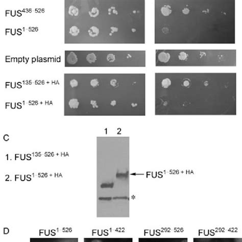 The full-length FUS protein is most aggregation-prone and toxic in ...