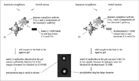 5 Radial Immunodiffusion Assay For Evaluation Of C1 Inhibitor Activity Download Scientific Diagram