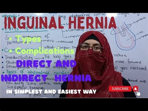 Inguinal Hernia | Direct and Indirect inguinal Hernia | Hasselbach ...