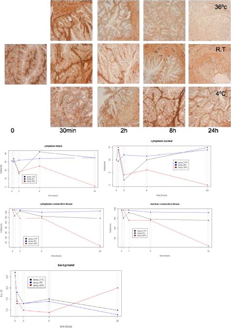 Impact Of Preanalytical Variables On PTEN Staining In EC Delayed