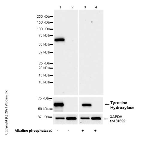 Recombinant Anti Tyrosine Hydroxylase Phospho S31 Antibody EPR26192