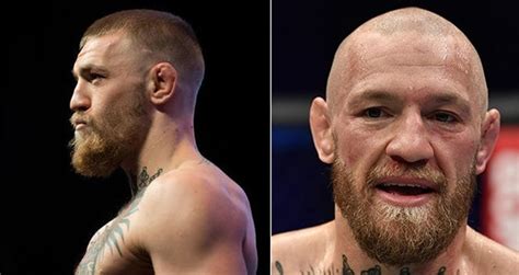 Conor McGregor Undergoes Incredible Body Transformation (Photos) - Game 7