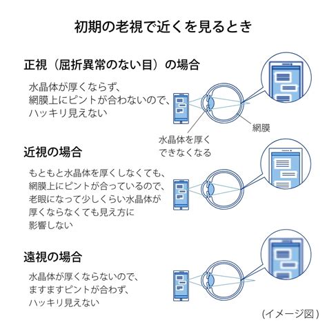 近視と遠視の違いとは？症状や見え方、レンズでの矯正方法について アキュビュー® 【公式】