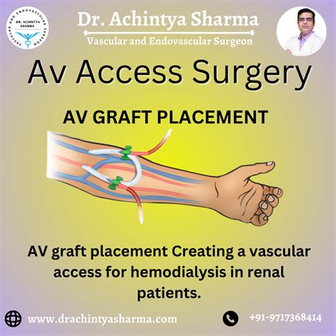 This Is Your Essential Guide To Understanding Av Access Surgery For