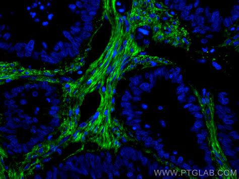 Fibronectin Antibody Cl488 66042 Proteintech 武汉三鹰生物技术有限公司