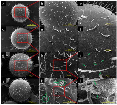 Water Free Full Text Embryotoxicity Of Polystyrene Microspheres Of