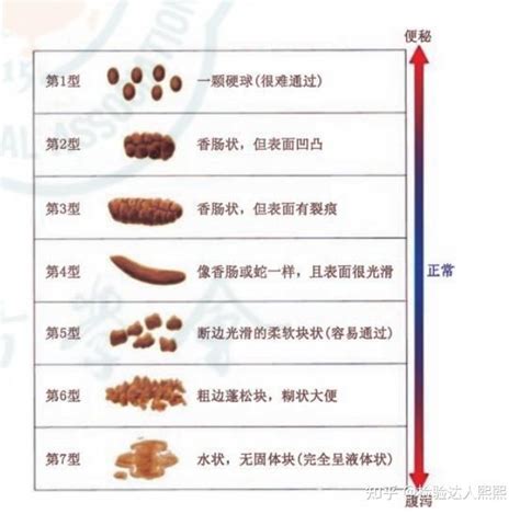 引起慢性腹泻的因素有哪些？ 知乎